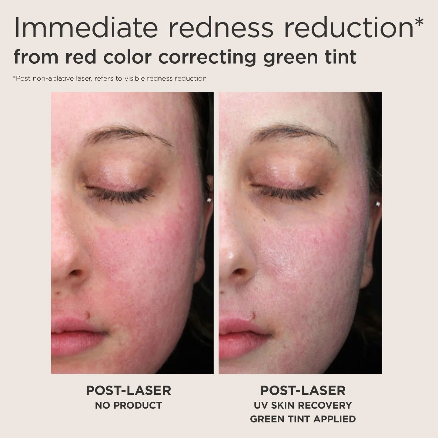EltaMD Post-Procedure Skincare Kit
